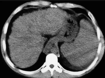 MATROMARINE MAXI MACERATOR PUMP 24V. BRASS, PART NO: 5500001024 / MÁY BƠM MATROMARINE MAXI MACERATOR 24V. ĐỒNG THAU, MÃ HÀNG HÓA: 5500001024